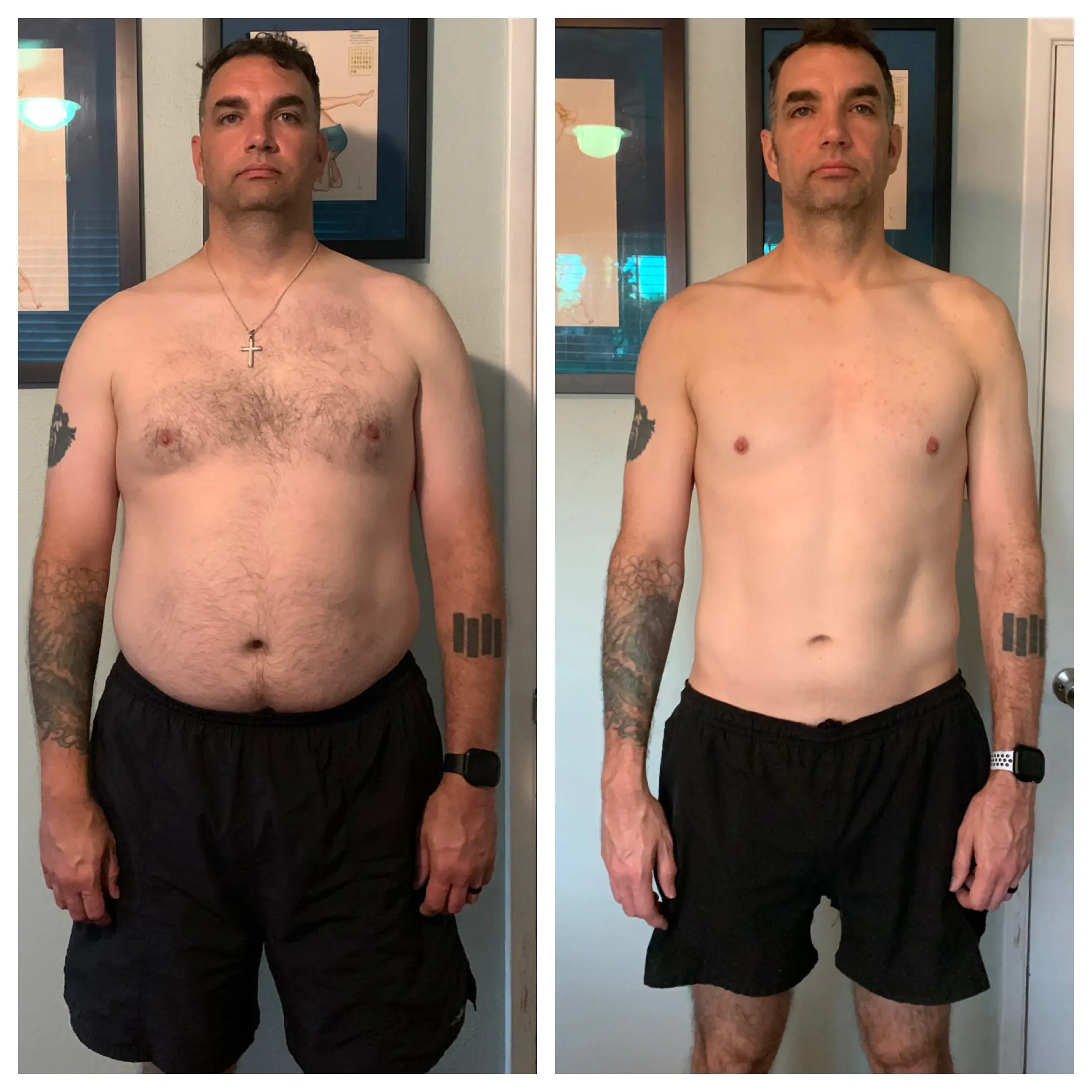 James before treatment